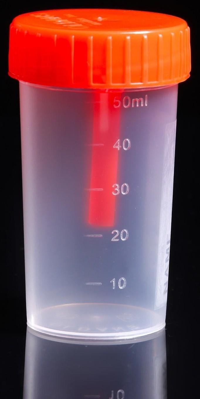 Контейнер для биоматериалов «Олданс» со шпателем стерильный, 60 мл