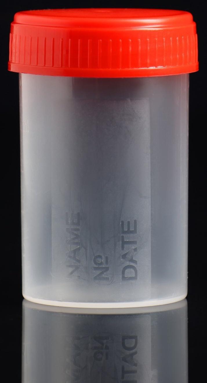 Контейнер без шпателя, стерильный, в индивидуальной упаковке, 60 мл