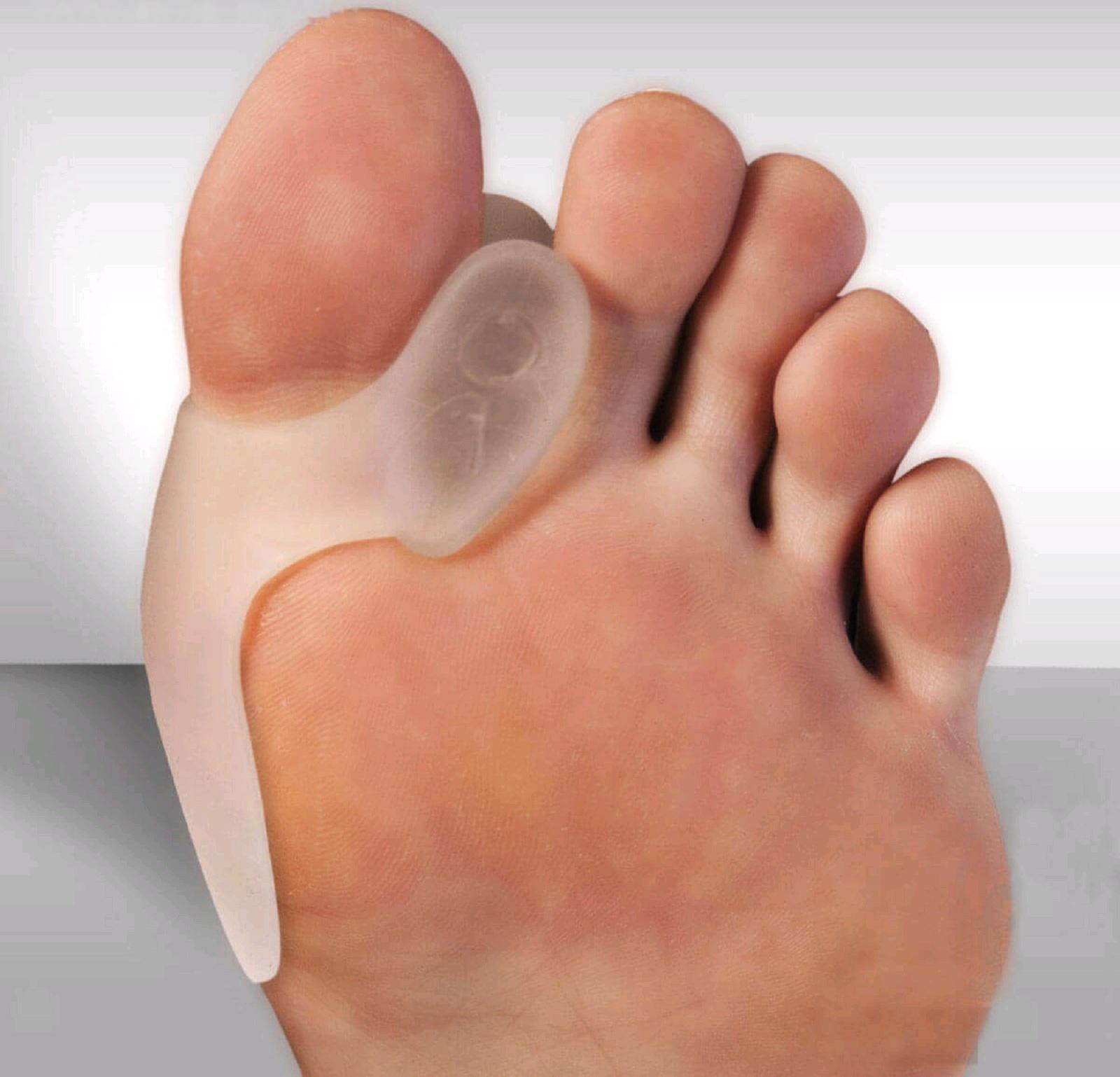 Бурсопротектор Forta Valgus Pro, с межпальцевой перегородкой