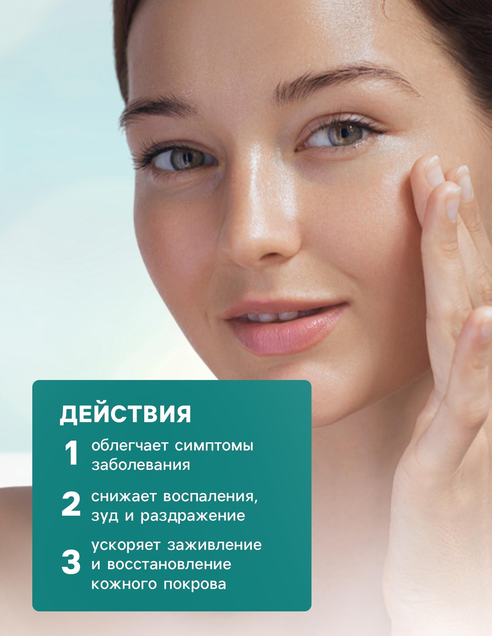 Мазь при псориазе, экземе, грибке, дерматите,