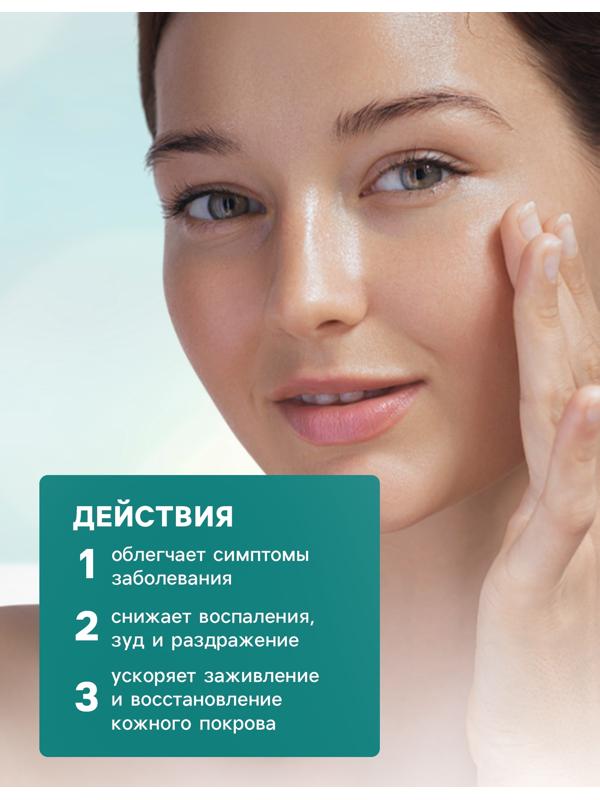 Мазь при псориазе, экземе, грибке, дерматите,