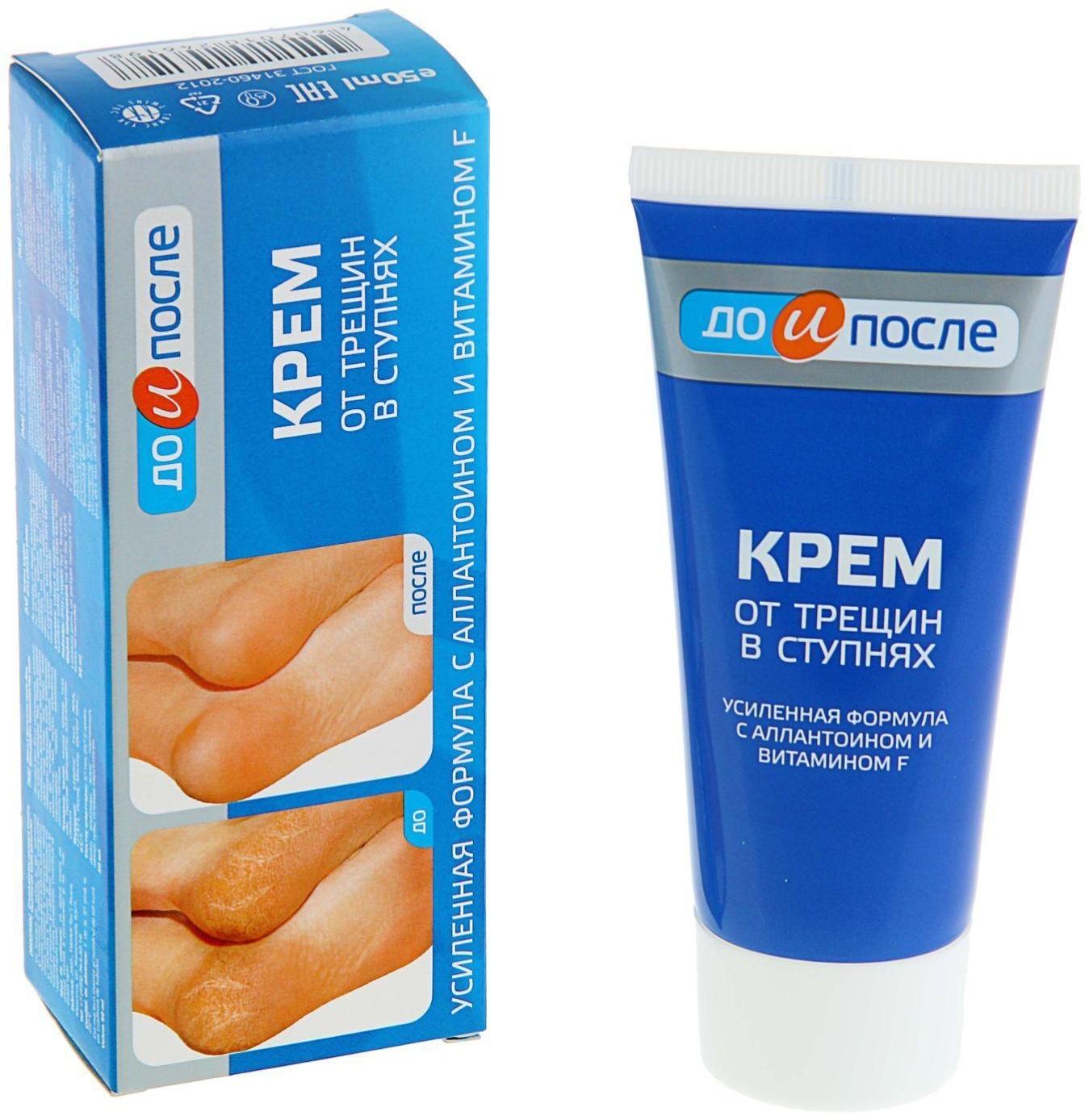 Крем для ног от трещин в ступнях, 