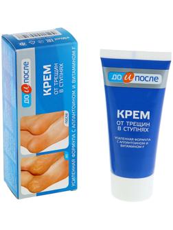 Крем для ног от трещин в ступнях, 