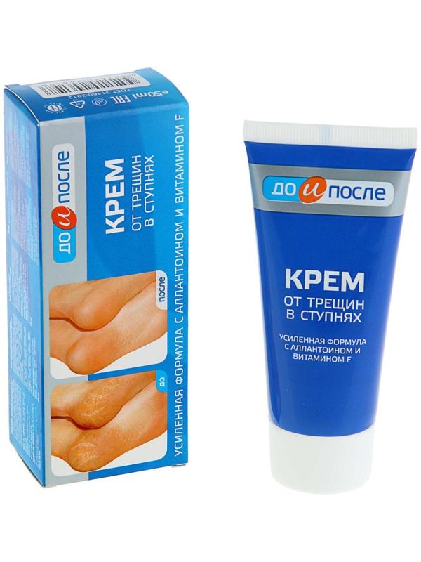 Крем для ног от трещин в ступнях, 