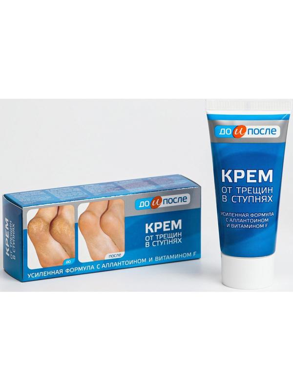 Крем для ног от трещин в ступнях, 