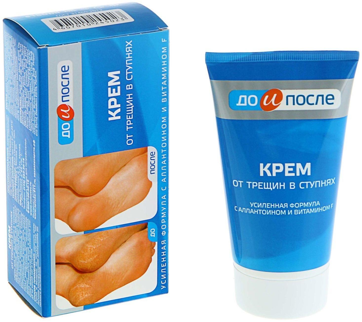 Крем для ног от трещин в ступнях, 