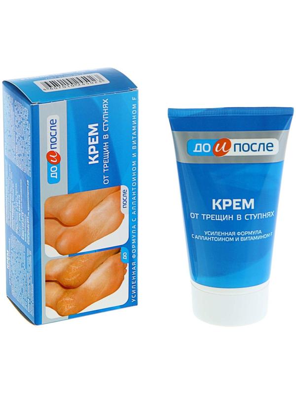 Крем для ног от трещин в ступнях, 