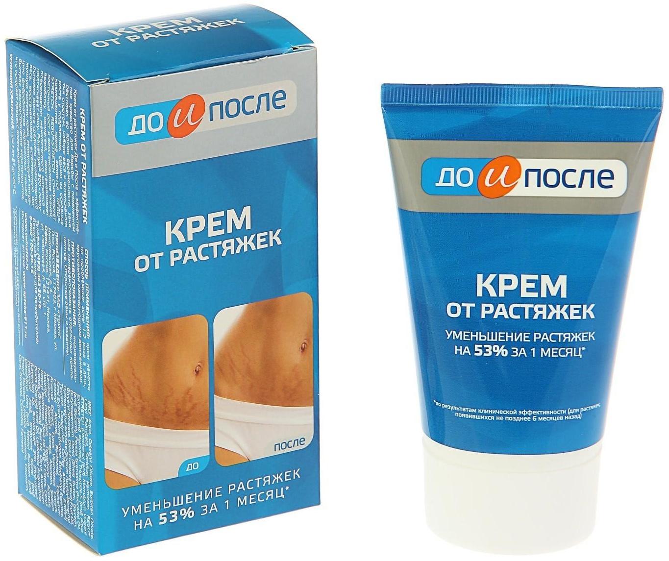 Крем от растяжек 