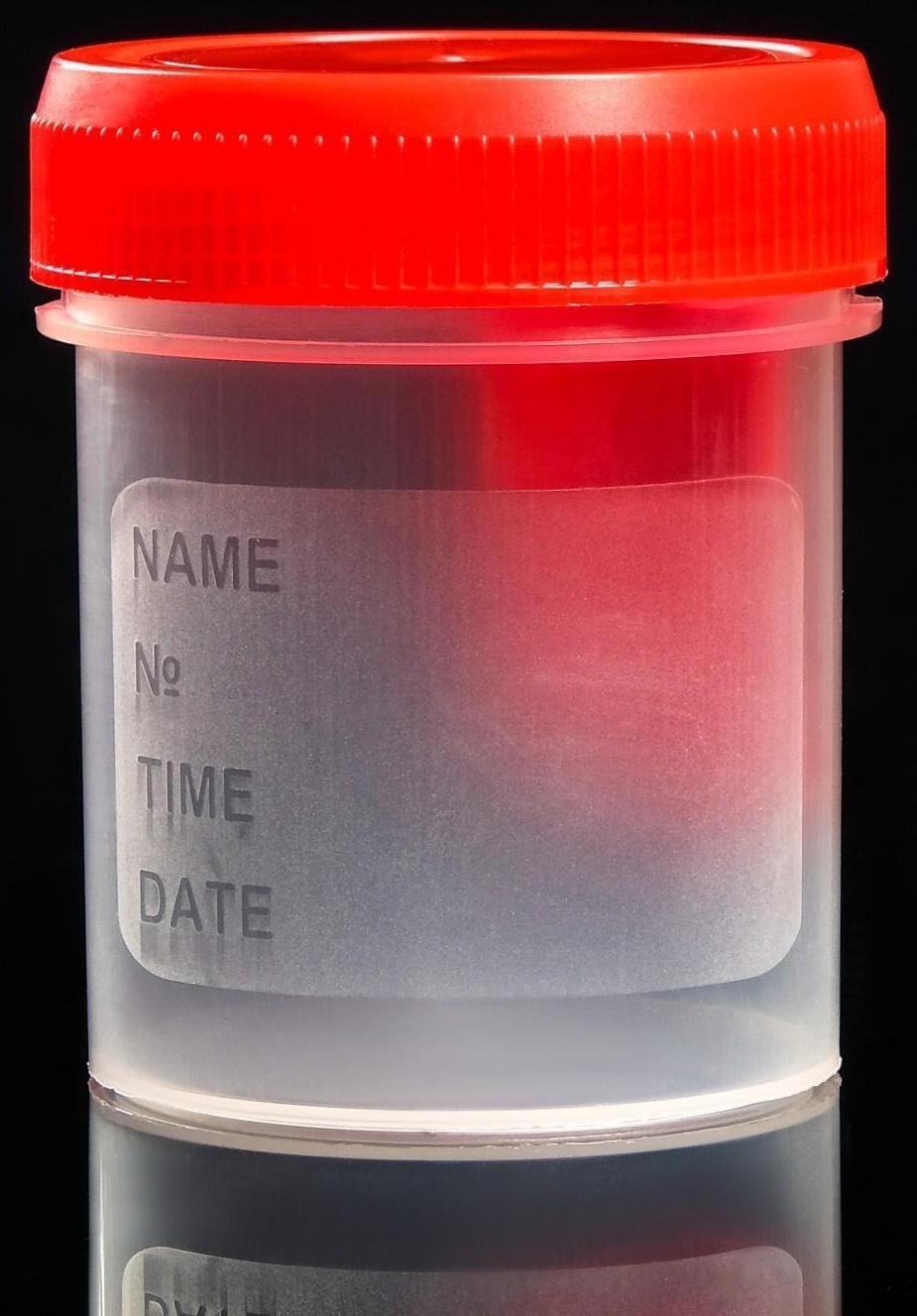 Контейнер для биопроб полимерный, стерильный, со шпателем, 60 мл