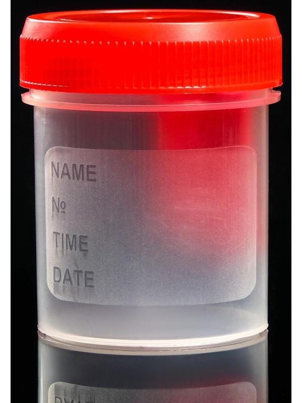 Контейнер для биопроб полимерный, стерильный, со шпателем, 60 мл