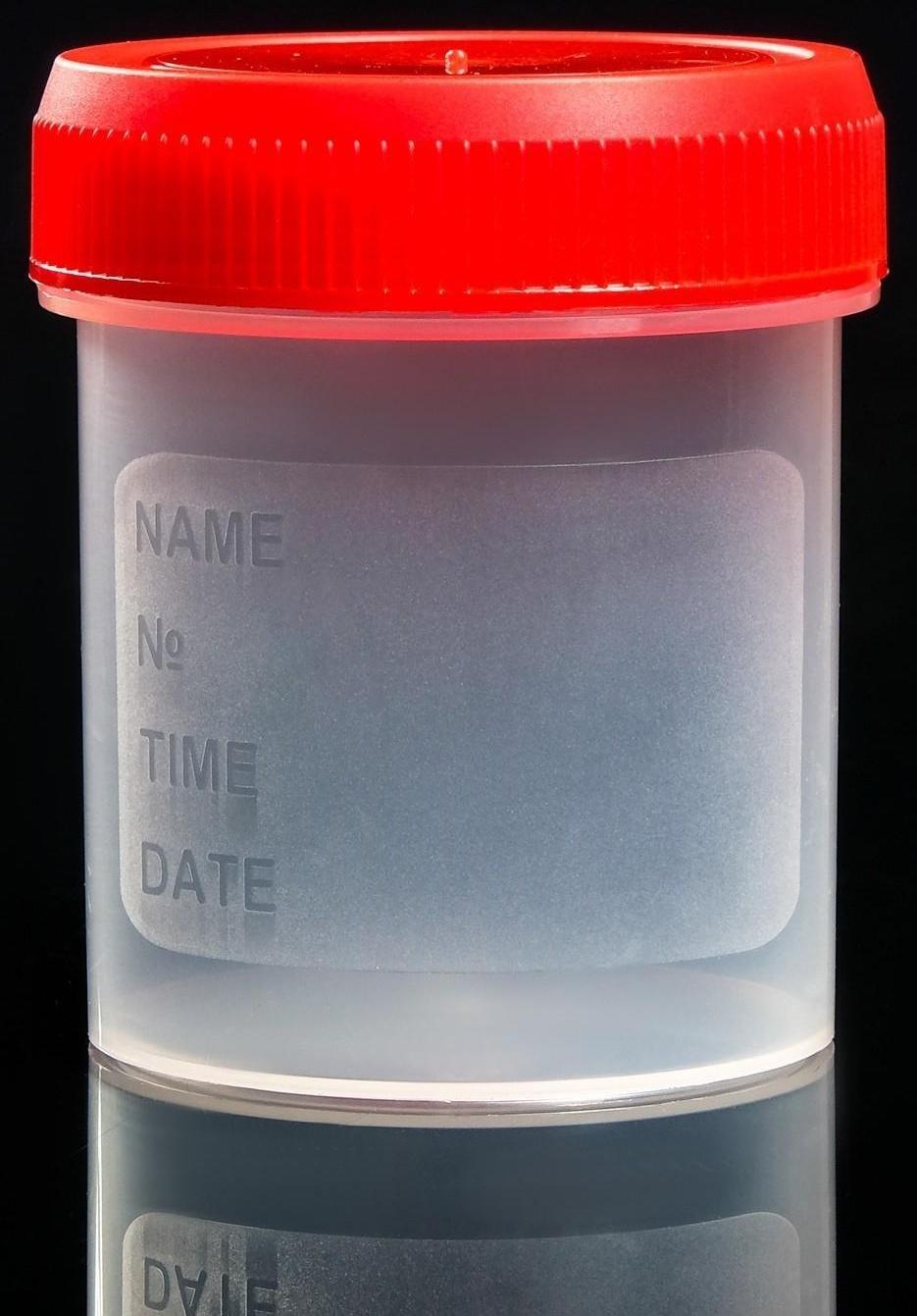 Контейнер для биопроб полимерный, стерильный, без шпателя, 60 мл