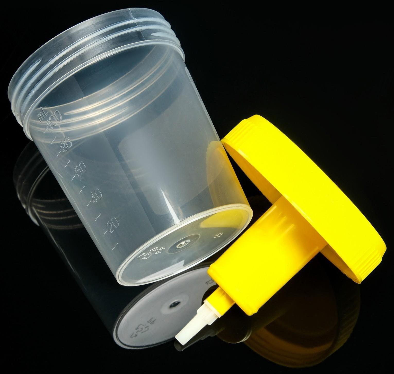 Контейнер стерильный со встроенным устройством для вакуумного забора мочи, 120 мл