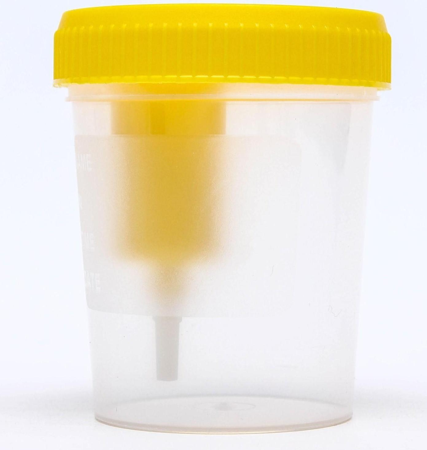 Контейнер стерильный со встроенным устройством для вакуумного забора мочи, 120 мл