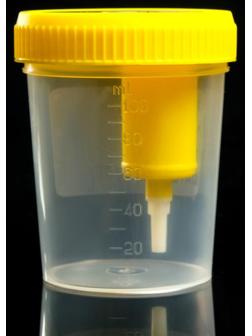 Контейнер стерильный со встроенным устройством для вакуумного забора мочи, 120 мл