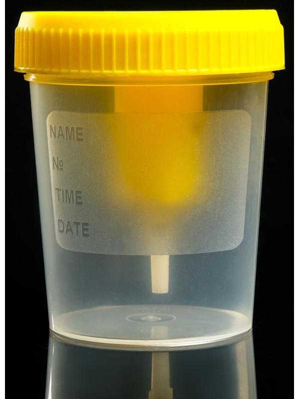Контейнер стерильный со встроенным устройством для вакуумного забора мочи, 120 мл