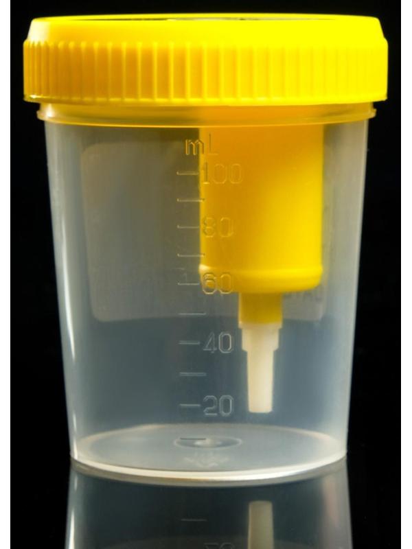 Контейнер стерильный со встроенным устройством для вакуумного забора мочи, 120 мл