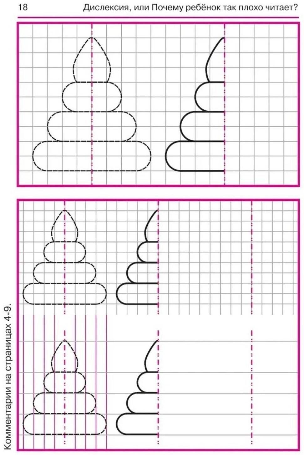 Дислексия, или Почему ребенок плохо читает? - Изд. 12-е; Воронина Т.П.