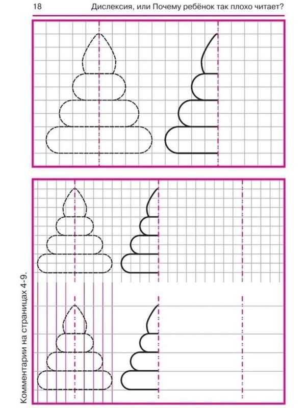 Дислексия, или Почему ребенок плохо читает? - Изд. 12-е; Воронина Т.П.