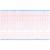 Лента тепл.регист. для CTG(FM) BIOSYS BFM-900, К11230АК12-CTG, 112х30х12, 7